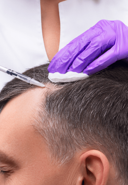 Hairline Reconstruction